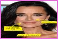 Botox, Implants & More! – Hollywood Life