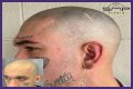 Unveiling The Truth: Steve Austin's Baldness Decoded
